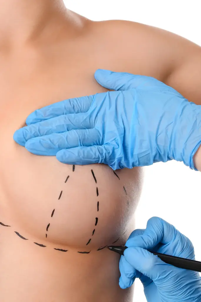 best breast lift and implants