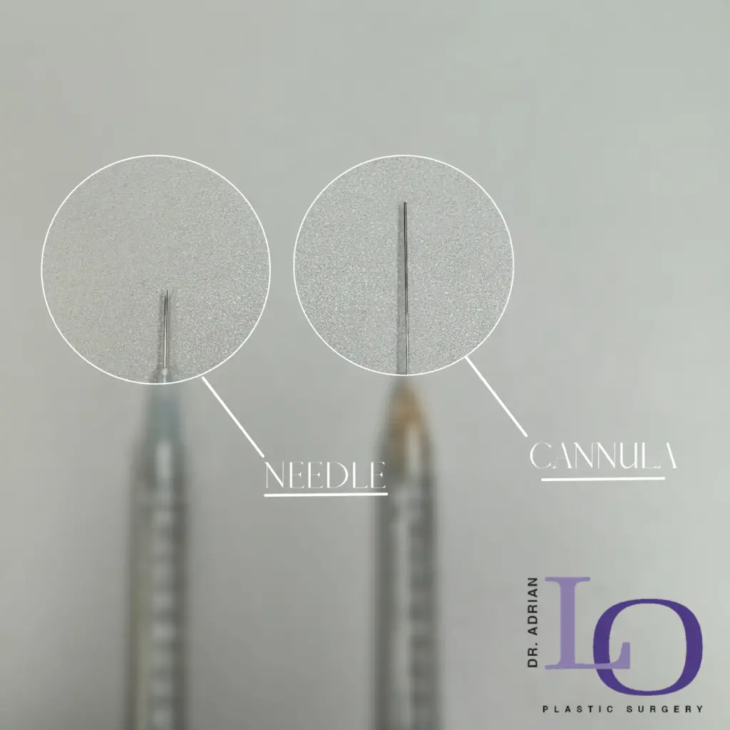 cannula vs needle filler