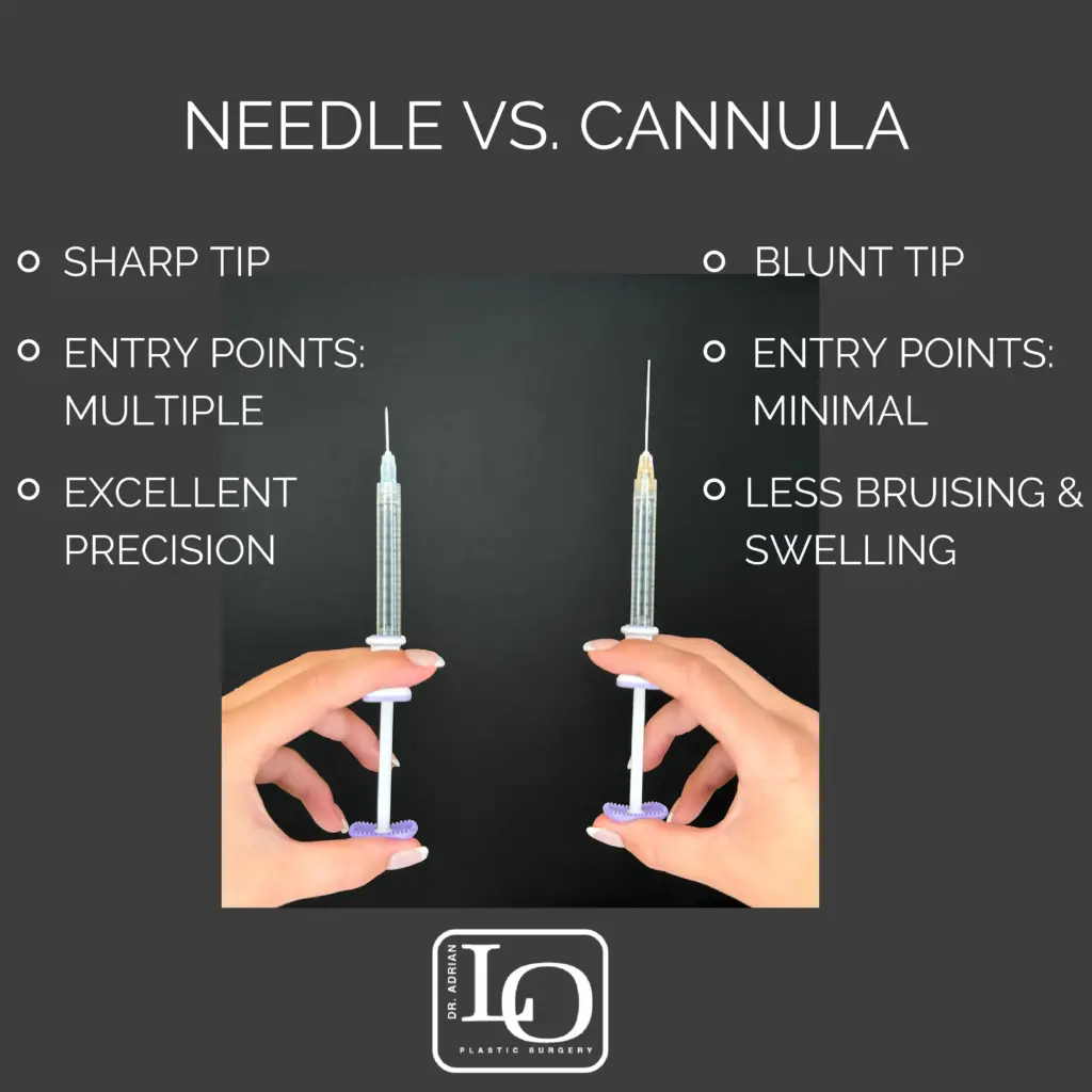 filler needle vs cannula