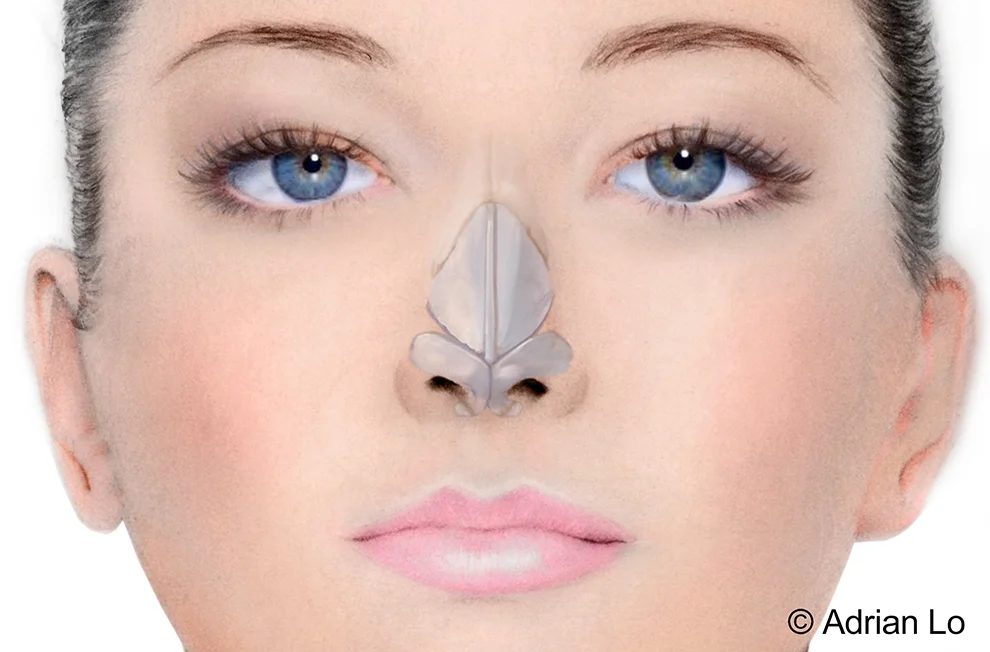 how much is a nose rhinoplasty