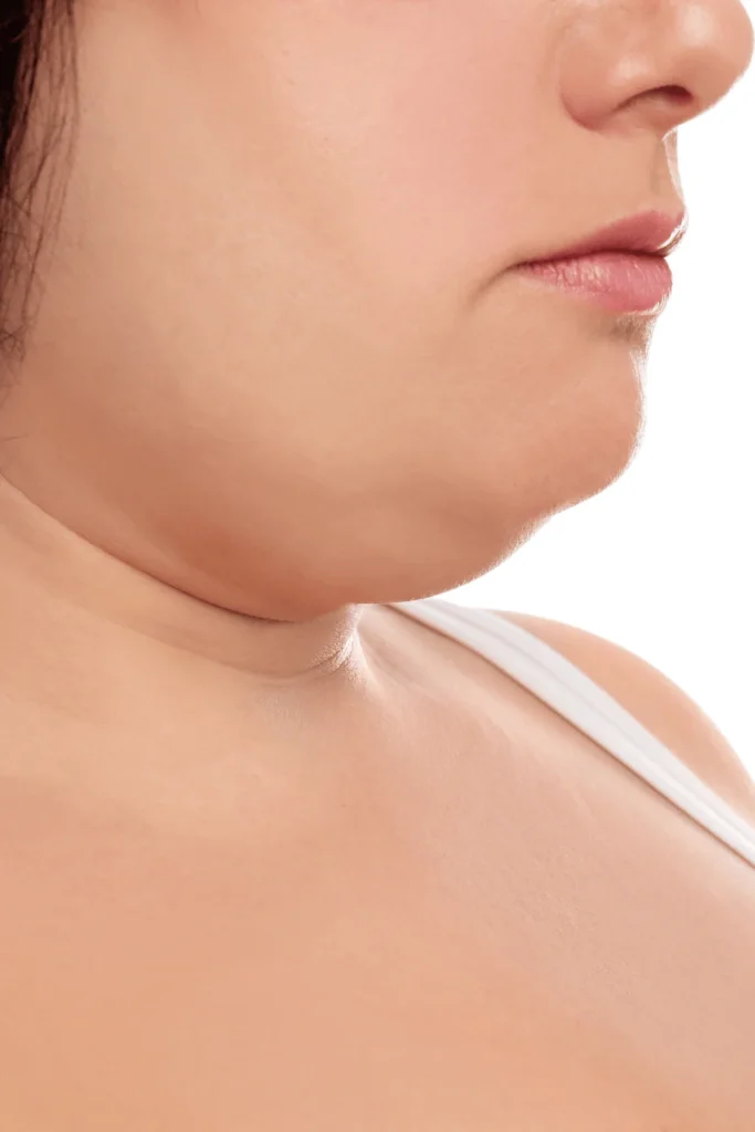 neck liposuction cost