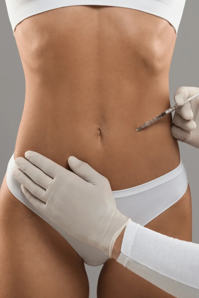 mini tummy tuck before and after