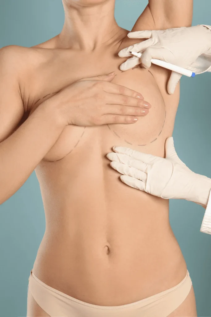 transgender breast augmentation surgeon measuring breasts