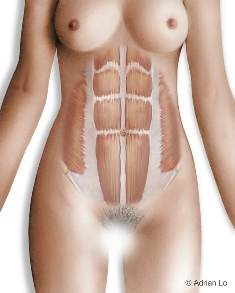 tummy tuck ab muscles lower torso